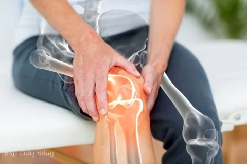 پیش بینی یک میلیارد مبتلا به آرتروز در جهان تا 2050